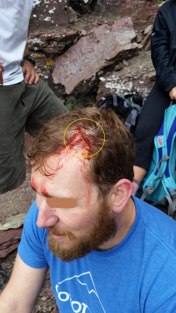 A climber hit his head on a sharp edge